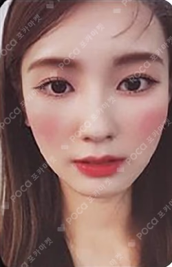 I burn FIRE ver. MIYEON photocard image